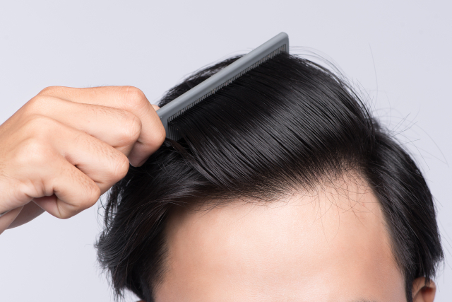 5 Reasons Why You Should Consider A Hair Replacement