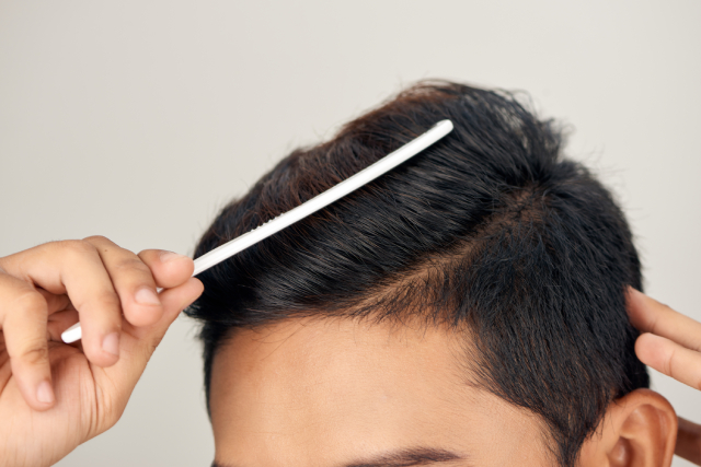 5 Factors To Consider When Choosing The Right Hair System